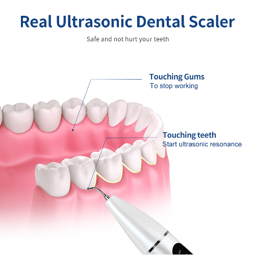 Removedor Limpiador Dental