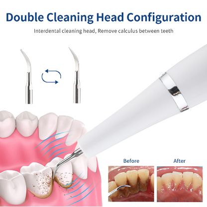 Removedor Limpiador Dental