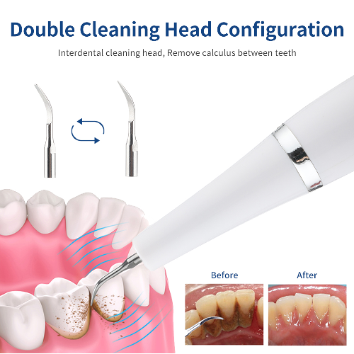Removedor Limpiador Dental